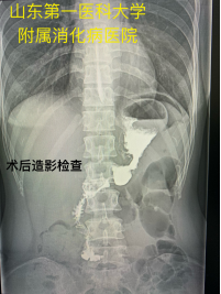 a853d13a87f046adf17ec9b57370a6f1.png